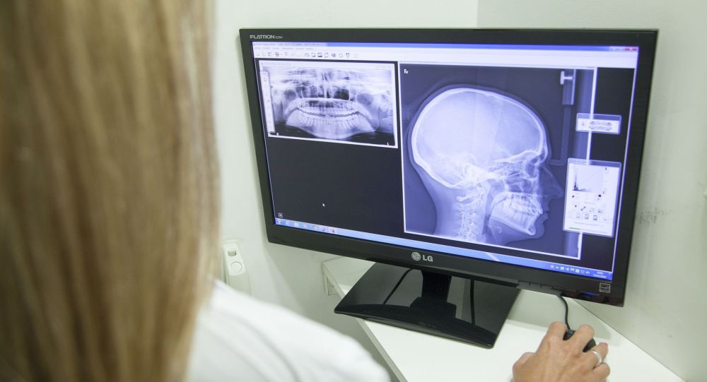Des scientifiques affirment avoir trouvé un vaccin contre une des dégénérescences d’Alzheimer