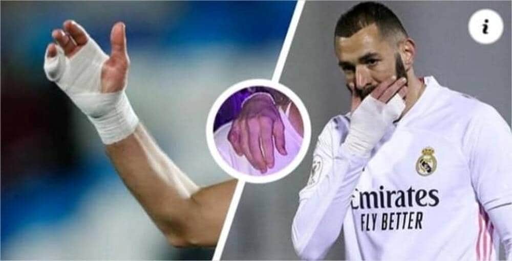 ⚽️ Pourquoi Karim Benzema joue-t-il en permanence avec un bandage à la main ? 3 db6327e30b8ae10063171bbb458b8cae 17750182