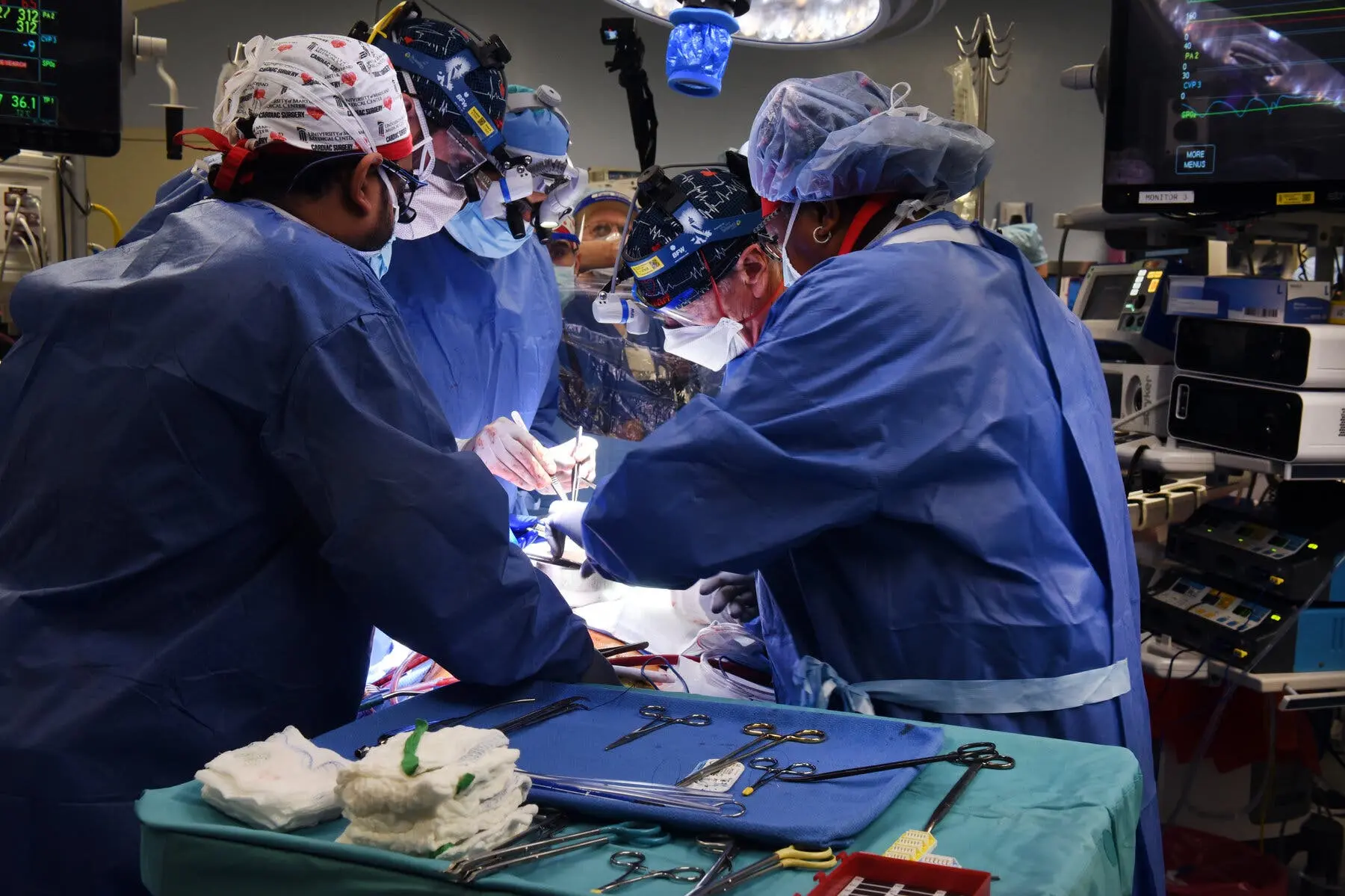 10transplant3