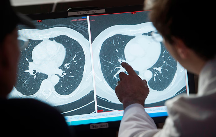 🌍 Hausse inquiétante des cancers chez les jeunes adultes : les scientifiques s’interrogent