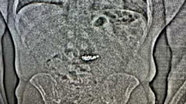 🇺🇲 Un voleur avale des bijoux en diamant à 770 000 $ pour tenter d’échapper à la police 2 image 35